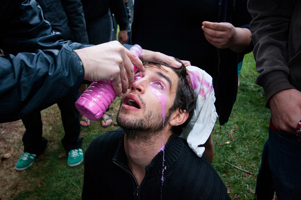 Students treat a protester with who was pepper sprayed with a mixture of Maalox and water on November 18, 2011 Davis, Calif. Lt. John Pike attained international infamy after he pepper sprayed a group of students who were sitting down with their arms linked. (BRIAN NGUYEN/THE CALIFORNIA AGGIE)